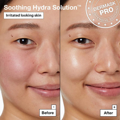 Dr. Jart+ Soothing Hydra Solution™ PRO Face Mask for Irritated Skin 26g*5pc